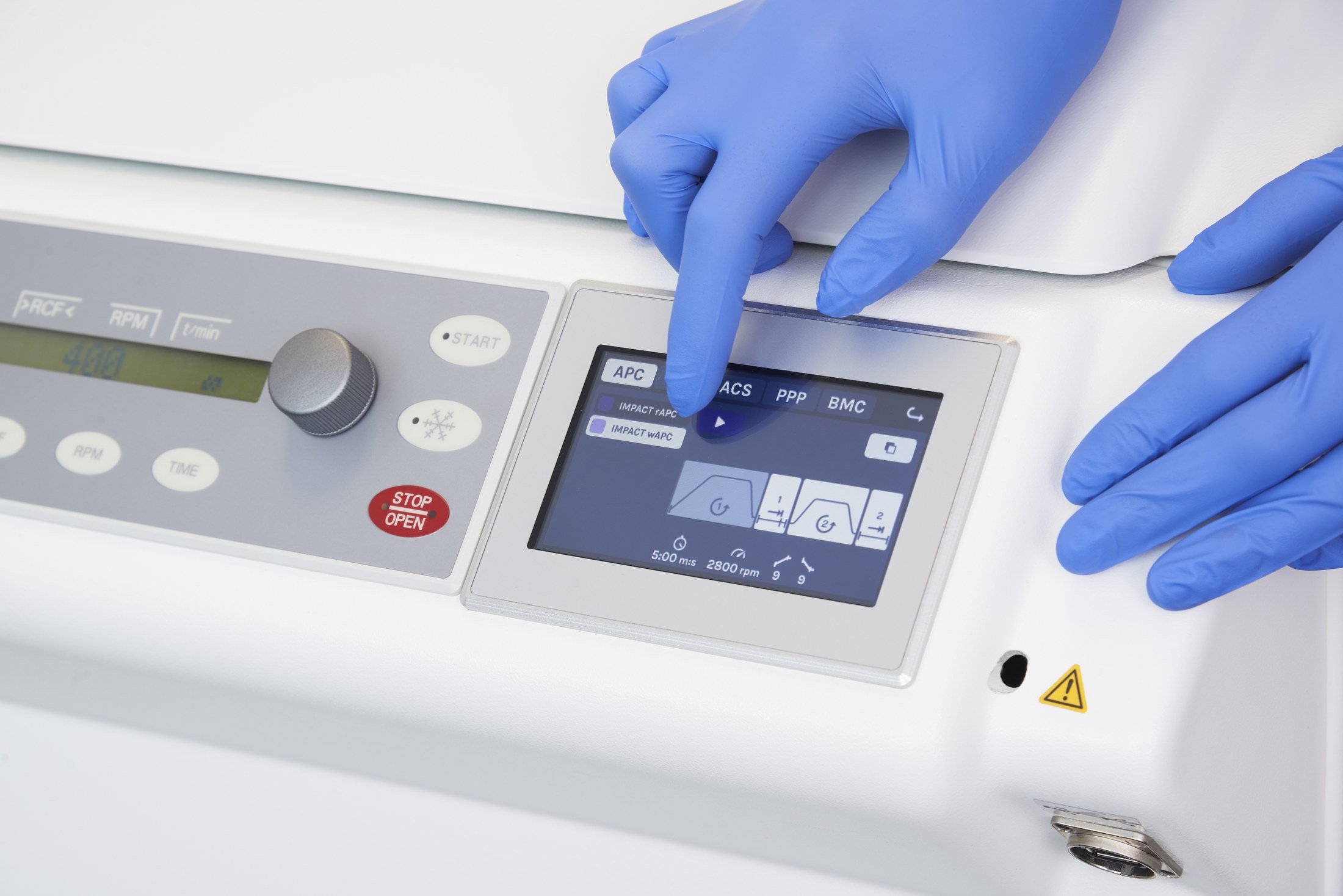 Automatisiertes Aufbereitungssystem